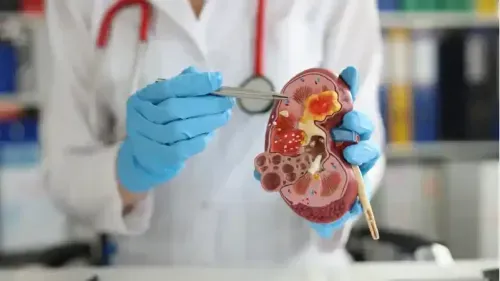 How to Stop Kidney Stone Pain Immediately?